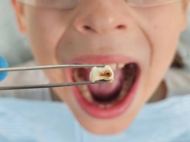 Best Same-Day Emergency Dental Services in Harrodsburg, KY